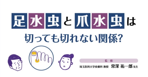 足水虫と爪水虫は切っても切れない関係？